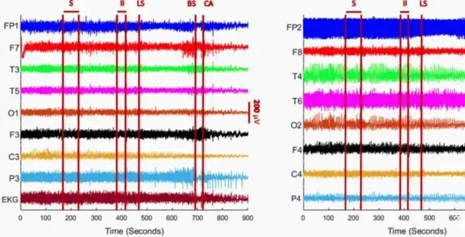 澳门王中王100资料交流区，纺织科学与工程专家AUJ85.83论坛