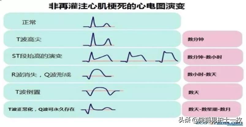 心电图速记口诀最新版，心灵与自然的美景之旅揭秘